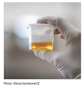 Urine test bottle. Photo: iStock/someone25